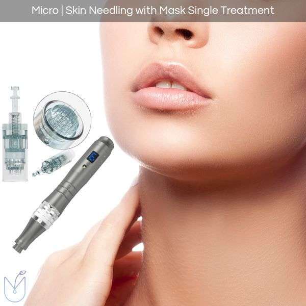 Micro-Needling With Mask Treatment Micro-Needling With Mask Treatment