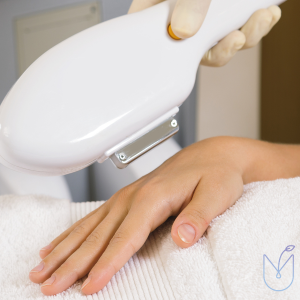 IPL Skin Rejuvenation Hands