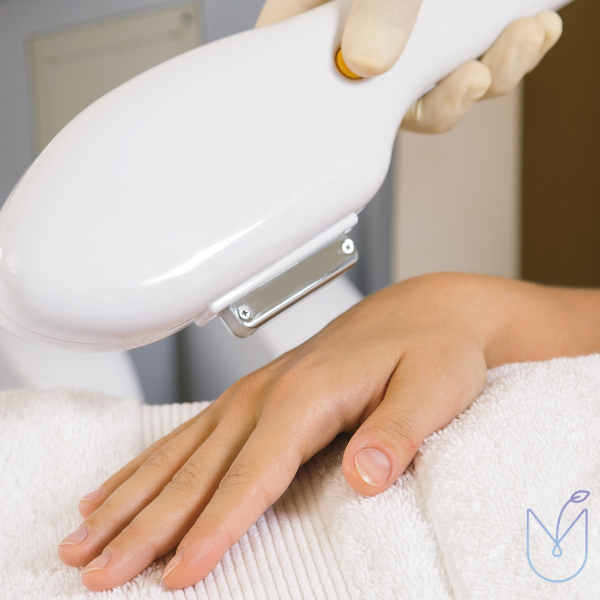 IPL Skin Rejuvenation Hands
