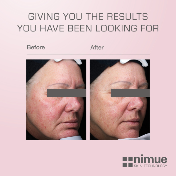 Nimue Daily Calm and Restore Moisturiser Nimue Daily Calm and Restore Moisturiser