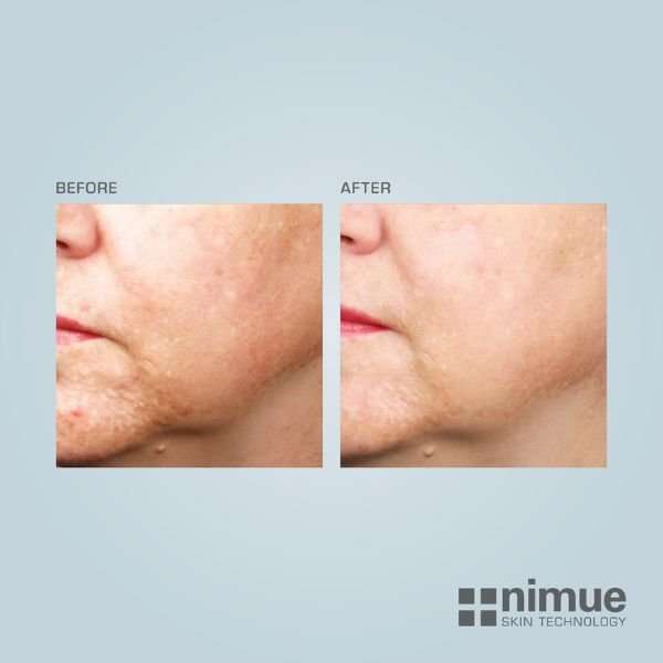 Nimue Night Fader Plus – 50ml Nimue Night Fader Plus – 50ml