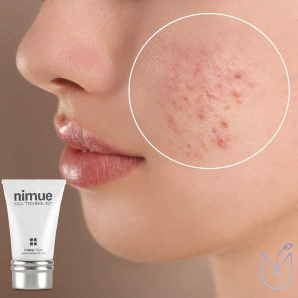 Nimue-Purifier-Day-at-Beauty-Lies-Within-in-Christchurch-3.png Beauty Lies Within Beauty Salon Christchurch