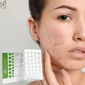 Clear touch Blemish Patches at beauty lies within Bryndwr Christchurch.jpg